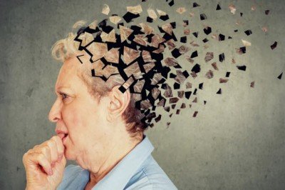 Alzheimer hastaları önce yakın geçmişi unutuyor
