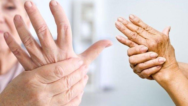 Dünyada 350 milyon kişide görülen artrit hastalığına dikkat!