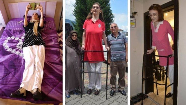 Dünyanın en uzun boylu kadını Rümeysa Gelgi, Guinness Rekorlar Kitabı’na girdi – Cumhuriyet