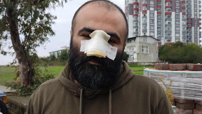 İş insanı dehşeti yaşadı! ‘Kendime aynada bakamıyorum’