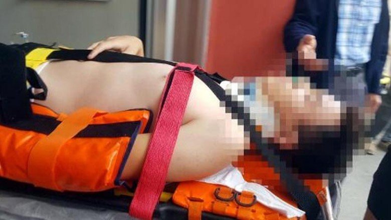 Kayseri’de korkunç olay! 4’üncü kat balkonundan düştü