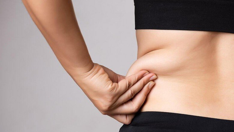Lipödem hastaları nasıl beslenmelidir?