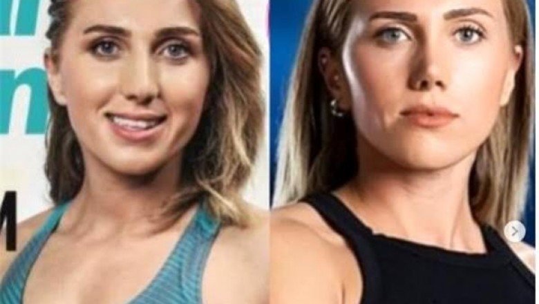 Survivor’da yarışan Meryem’in estetiksiz hali ortaya çıktı