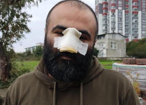 İş insanı dehşeti yaşadı! ‘Kendime aynada bakamıyorum’