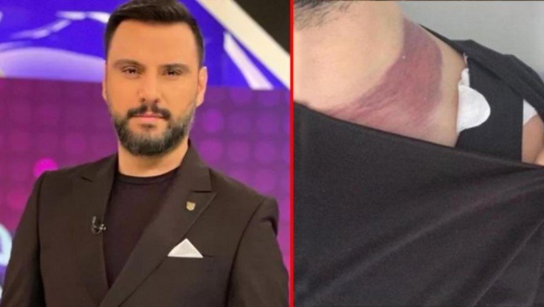 Yağ aldırma ameliyatında ölümden dönen Alişan’dan doktora rekor tazminat davası – Haberler.com