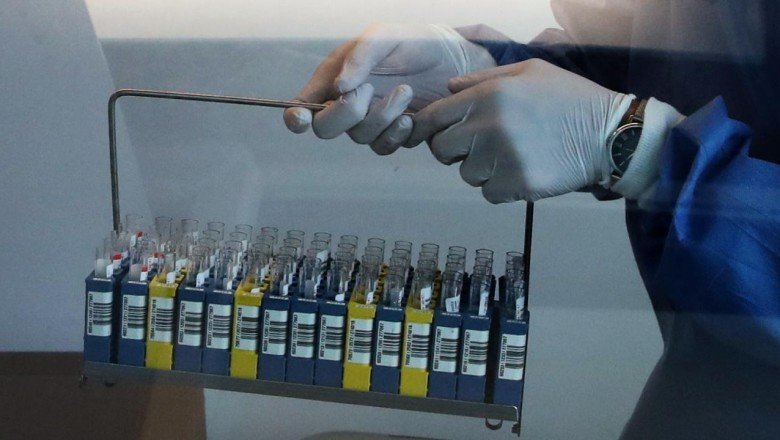 Belçika’da koronavirüs test merkezlerinin kapasiteleri doldu