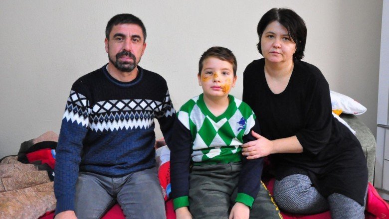Köpek saldırısına uğrayan Mert’in yüzüne 60 dikiş atıldı
