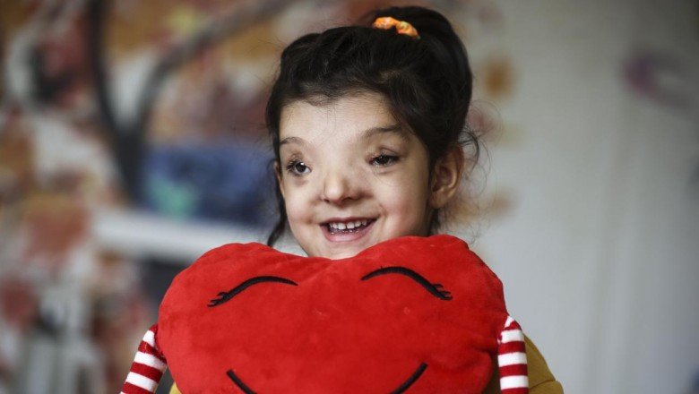 Minik Ayşenur’un normalden daha ayrık olan gözleri ameliyatla yaklaştırıldı