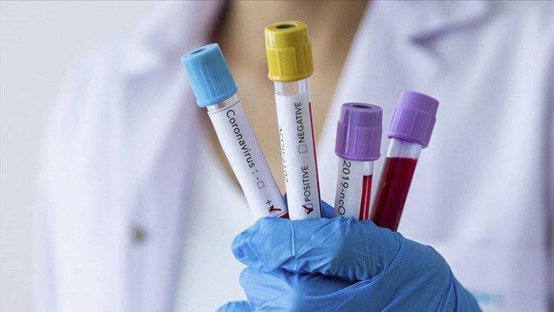 Prof. Dr. Tecer: Havada koronavirüsün RNA’sına rastladık