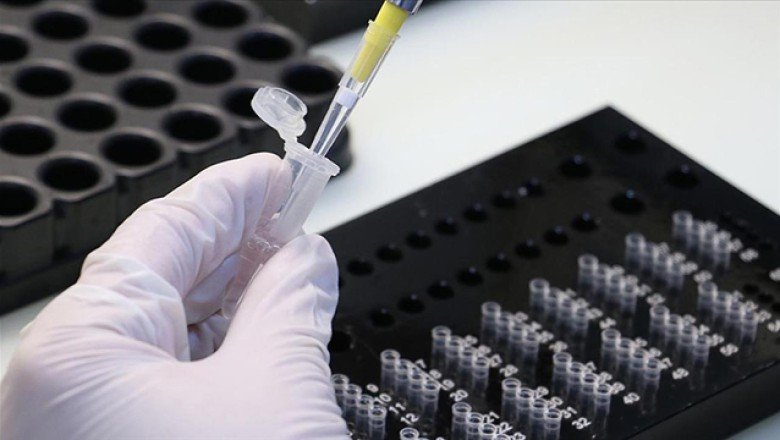 ABD’den uçuştan 24 saat önce test zorunluluğu
