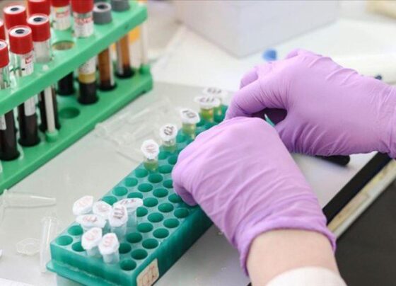 Evlilik öncesi SMA testleri zorunlu olacak: İşte detayları…