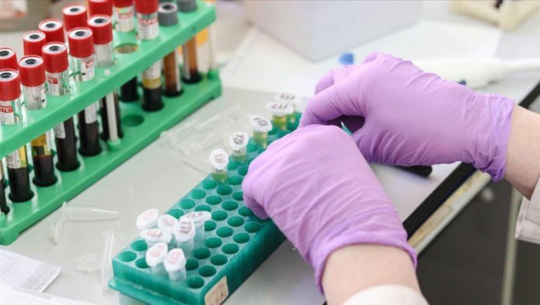 Evlilik öncesi SMA testleri zorunlu olacak: İşte detayları…