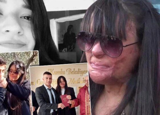 Türkiye günlerce Berfin Özek’i konuşmuştu! Yüzüne asit atan erkek arkadaşıyla evlendi
