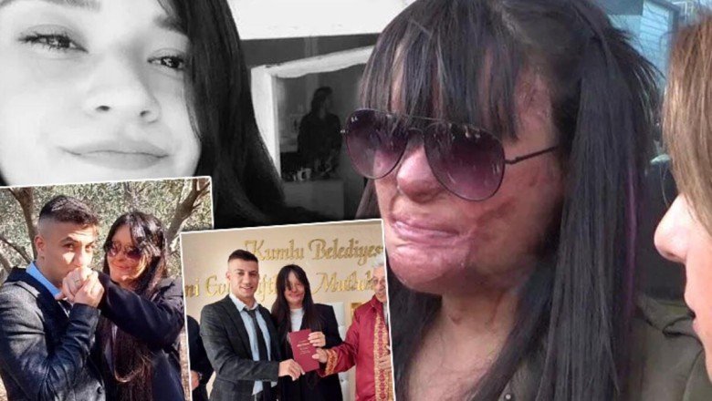 Türkiye günlerce Berfin Özek’i konuşmuştu! Yüzüne asit atan erkek arkadaşıyla evlendi