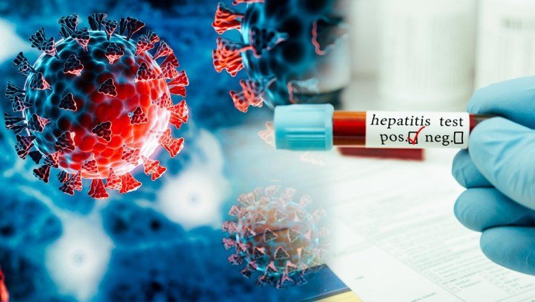 COVID19 olmasaydı Gizemli hepatit olur muydu?