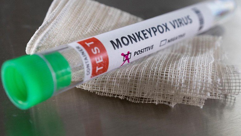 Maymun çiçeğine potansiyel antiviral tedavi