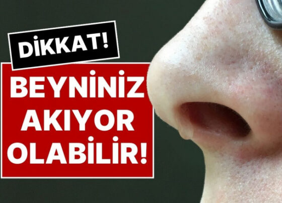 Geçmeyen Burun Akıntısının Nedeni Nedir? Beyin Sıvınız Akıyor Olabilir!